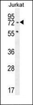 SLFN12L antibody