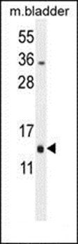 RM51 antibody