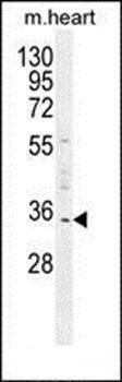 UPP2 antibody