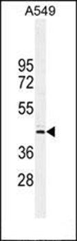 CT112 antibody