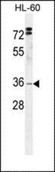 DC12 antibody