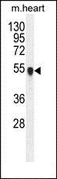 PPM1L antibody