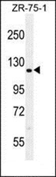 CCD33 antibody