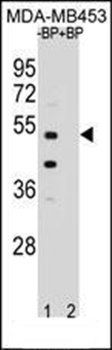 WDR51B antibody