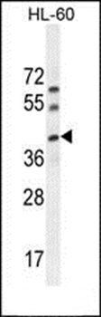 C17orf59 antibody