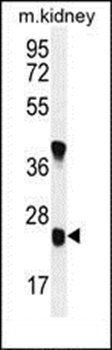 U119B antibody