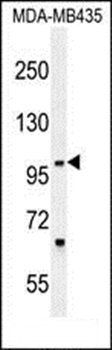 ZNF512B antibody