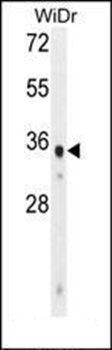 WDR5B antibody