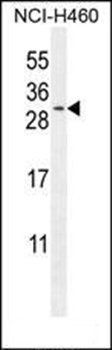 C2orf51 antibody