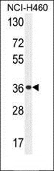 OR4A47 antibody