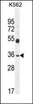 SULT1C3 antibody