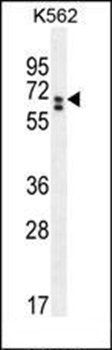 CLIP3 antibody