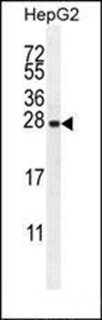 IRGM antibody