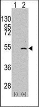 ELP3 antibody