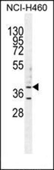 B3GALT5 antibody