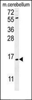 ANR39 antibody