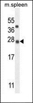 K1143 antibody