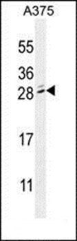 MBD3L2 antibody
