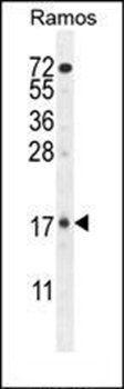 TTC9C antibody