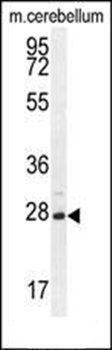 VSTM2A antibody