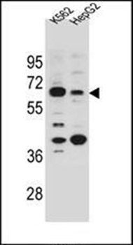 NHEDC1 antibody