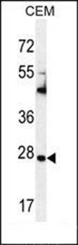 TIMP1 antibody