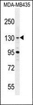 GLTSCR1 antibody