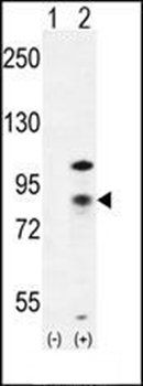 CTNB1 antibody