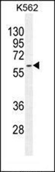 KRT73 antibody