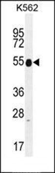 KRT25 antibody