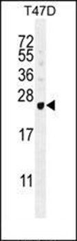 GAGE12B antibody