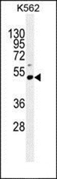 PRAMEF10 antibody