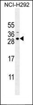 SPACA5B antibody