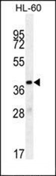 OR10J5 antibody
