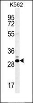 CT45A1 antibody