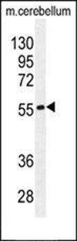 FAM69B antibody