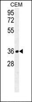 NUDT22 antibody