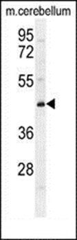 CYB5D2 antibody
