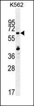ZNF619 antibody