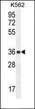 ETV2 antibody