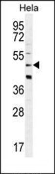CRFR2D antibody