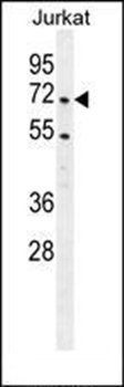 PRMT4 antibody