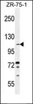 TLL2 antibody