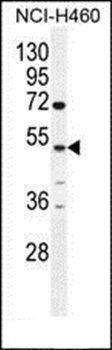 CPA6 antibody