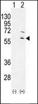 RPS6KL1 antibody