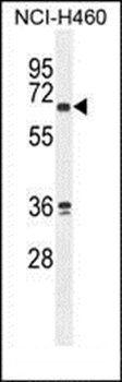 ZNF813 antibody