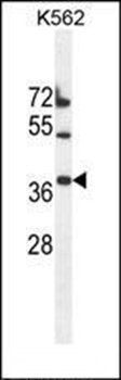 TMEM150B antibody