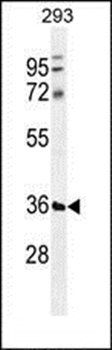 TMCO5B antibody