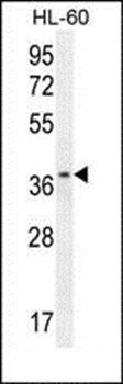 ZNF322B antibody