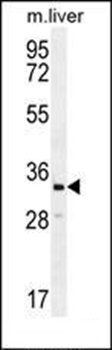 RLBP1L2 antibody